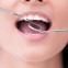 Dental Hygiejne tandrensning 3-sæt - 1 Mundspejl, 1x Curette tandrenser, 1 scraper