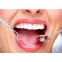 Tandrensningssæt 4 dele  til Dental Hygiejne - 1 Mundspejl, 2x Curette tandrenser, 1 scraper