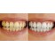 White Master® Coco Coal Teeth Whitening - Kul tandpasta 30 gram